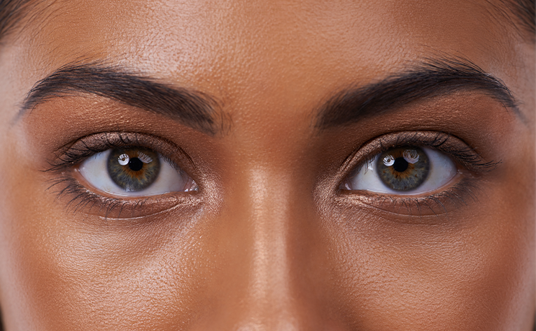 eyebrow grafting london