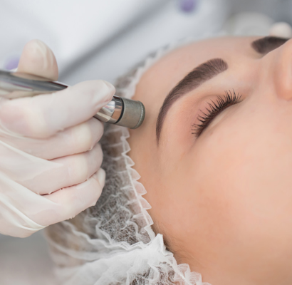 2_Microdermabrasion