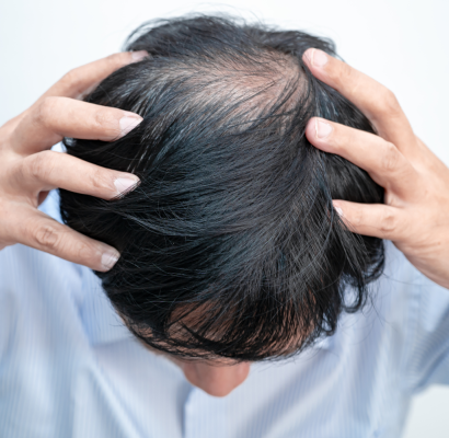Hair_Transplant procedure london