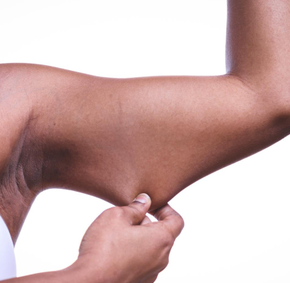 non surgical arm lift london