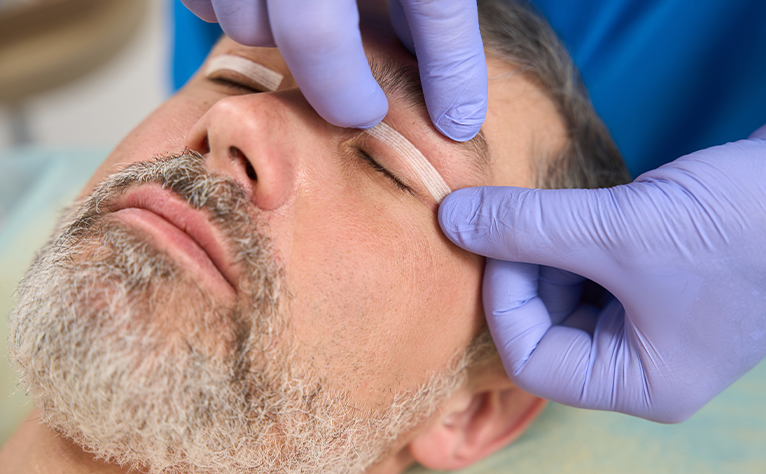 5_Blefaroplasty