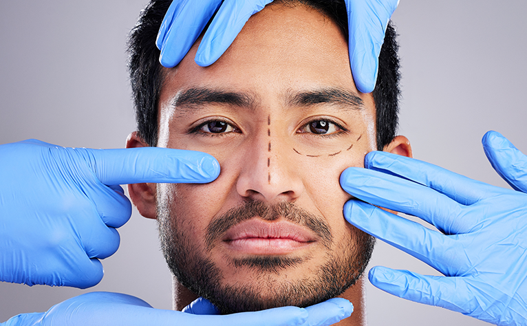 5_Men_Rhinoplasty