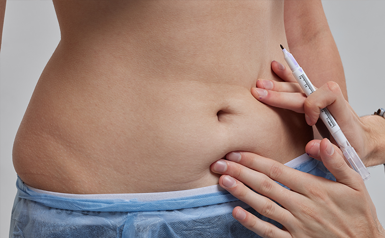 abs fibrosis treatment in london